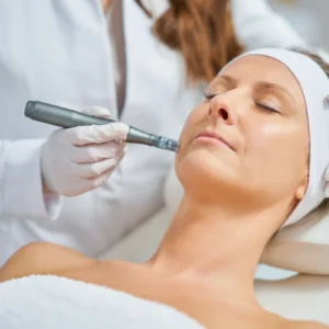 Tratamiento facial Dermapen