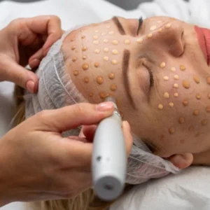 Tratamiento facial BB-GLOW piel de porcelana