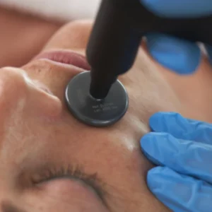 Radiofrecuencia Indibia facial